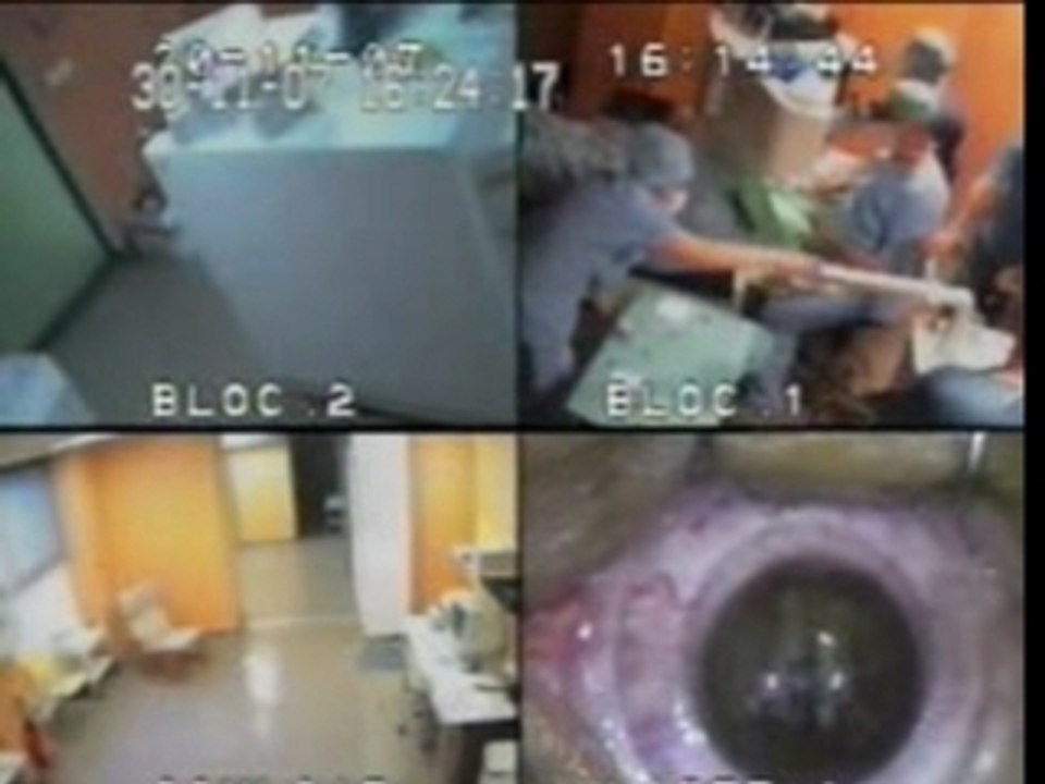 OEIL