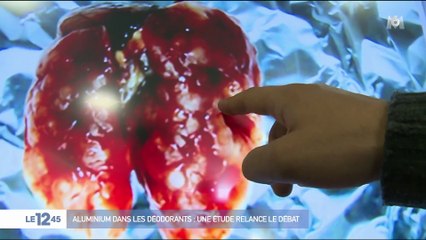 Aluminium dans les déodorants : une étude relance le débat