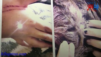 Hibapress| خطير...زوجة تحكي تفاصيل ليلة الرعب التي عاشتها بعد اختطافها من داخل منزلها بفاس