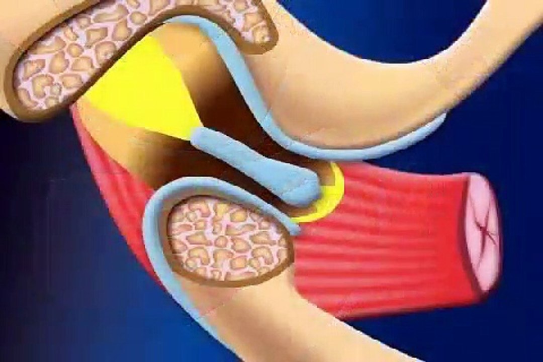 Gibt es eine Craniomandibuläre Dysfunktion?