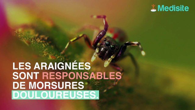 5 trucs qui apaisent vite les morsures d'araignées