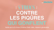5 trucs contre les piqures qui enflent