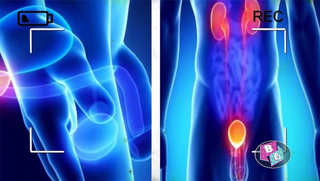 dbb-Humberto Vargas y su conciencia con el cáncer de próstata-201118