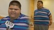 World’s heaviest teenager Mihir Jain undergoes gastric bypass surgery | Oneindia News