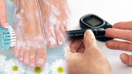Monsoon Tips:Diabetes Patients| डायबिटीज के मरीज बारिश में अपने पैरों का ऐसे रखें खास ख्याल| Boldsky