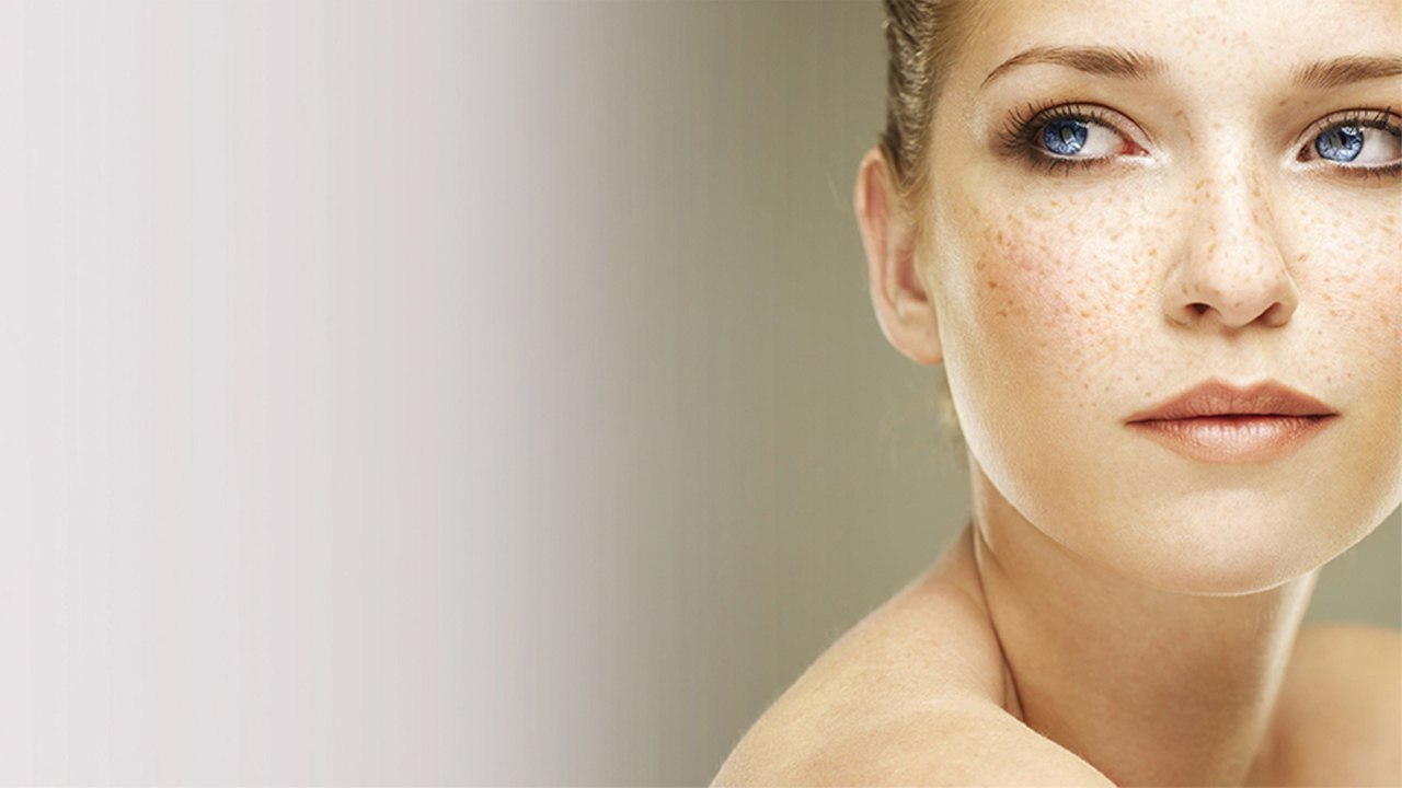 Reason of Pigmentation on skin| झाइयां होने की असल वजह, जाने कैसे होंगी दूर  | Boldsky