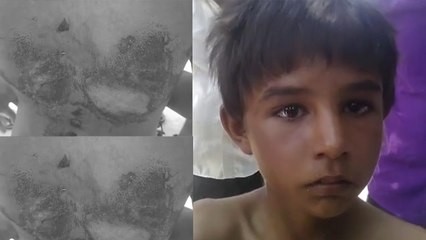 पति के साथ मिलकर सौतेली मां ने बेटे को बर्बरता से पीटा, वीडियो