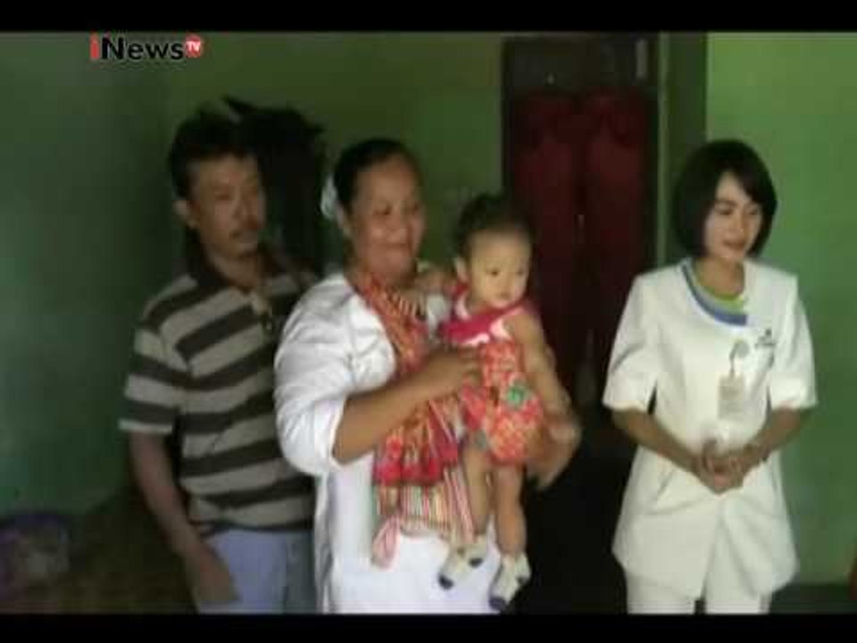 Jalinan kasih mengadakan pengobatan gratis Operasi bibir sumbing - iNews Pagi 25/02