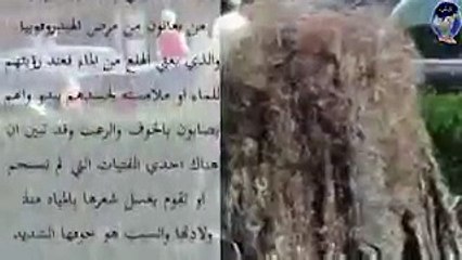 فتاة لم تغسل شعرها منذ ولادتها تعرف على السبب