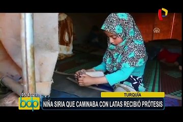 Turquía: niña con desorden congénito que caminaba con latas, recibió prótesis