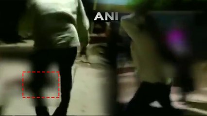 शराब के नशे में हैवान पिता ने 3 साल के मासूम की बुरी तरह की पिटाई