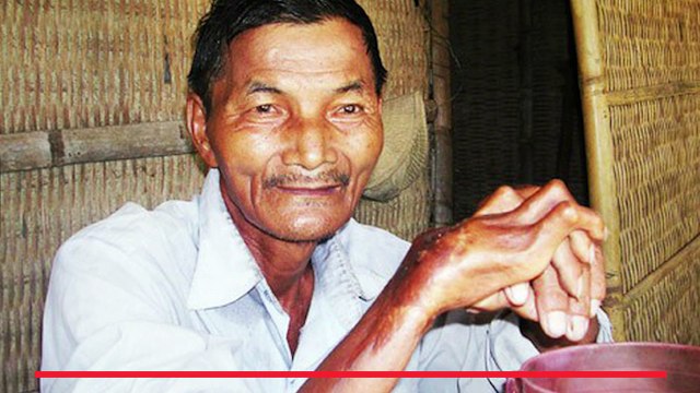 Những con người lạ kỳ và đặc biệt nhất trên thế giới khiến mọi người không thể hiểu được