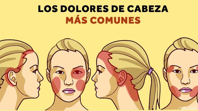 Los dolores de cabeza más comunes y cómo remediarlos ¡¡¡Dile adiós a las Migrañas!!! by rolloid