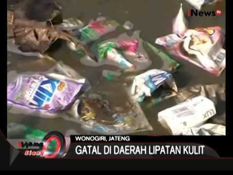 Mandi Dengan Air Comberan Warga Wonogiri Terserang Scabies - iNews Siang 28/07
