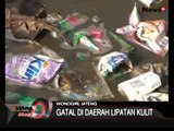Mandi Dengan Air Comberan Warga Wonogiri Terserang Scabies - iNews Siang 28/07