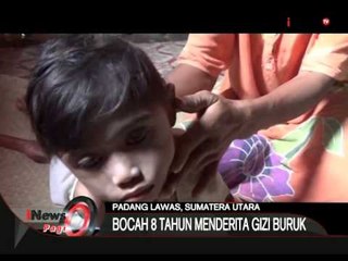 Bocah 8 Tahun Menderita Gizi Buruk - iNews Pagi 18/08