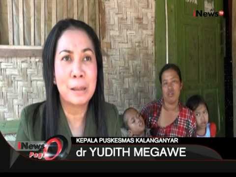 Akibat Gizi Buruk Dan Kemiskinan, Satu Keluarga Alami Kelumpuhan Di Lebak, Banten - iNews Pagi 06/10