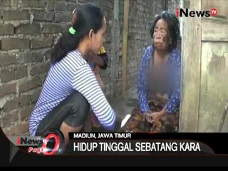 Nenek Sebatang Kara Dan Lumpuh Potret Jaminan Sosial Yang Gagal - iNews Pagi 13/10