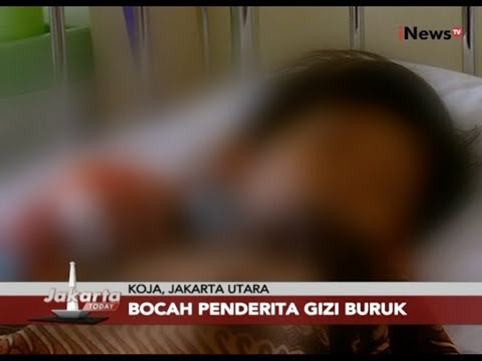 Miris!!! Ditengah Megahnya Jakarta Masih Ada Saja Balita Penderita Gizi Buruk - Jakarta Today 11/11