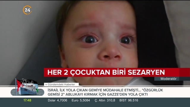 Her 2 çocuktan biri sezaryen
