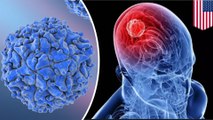 Genetically modified polio virus used to treat brain cancer