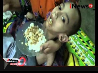 Kisah bocah 10 tahun yang menderita gizi buruk di Purworejo, Jateng - iNews Siang 24/03