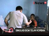 Korban ledakan bom di Universitas Haluoleo mengalami gangguan pendengaran - iNews Siang 31/03