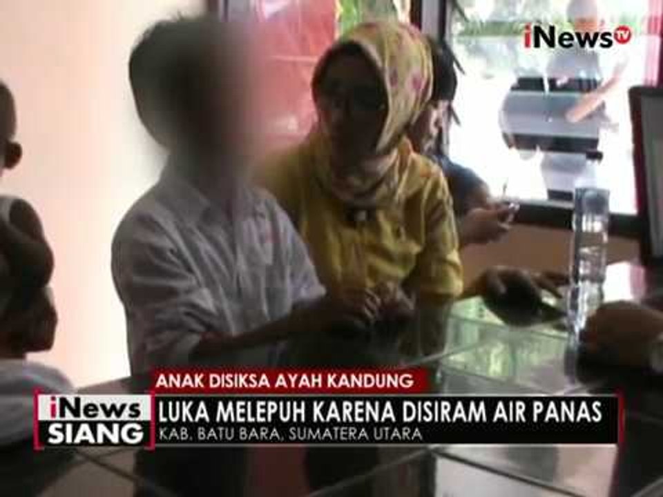 Miris, seorang anak di Kab. Batu Bara, Sumut disiksa oleh ayah sendiri - iNews Siang 24/05