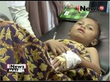 Santap Bakso keliling, puluhan warga keracunan di Sumatra Utara - iNews Malam 08/06