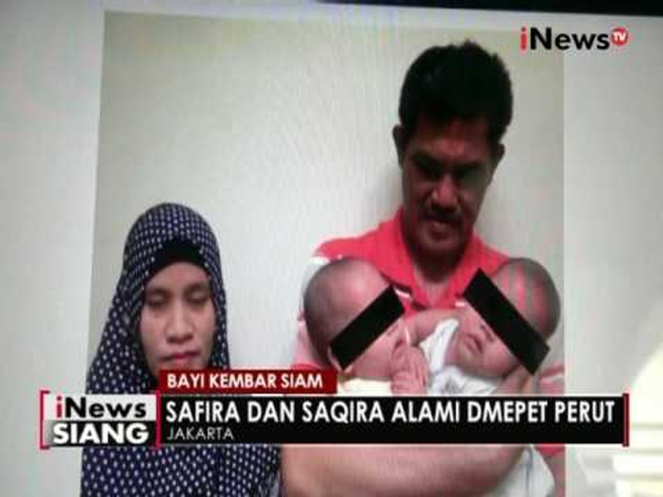 RS Mangukusomo berhasil pisahkan bayi kembar siam asal Bengkulu - iNews Siang 22/07