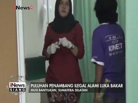 Puluhan Penambang Ilegal alami luka bakar karena sumur meledak - iNews Siang 12/01