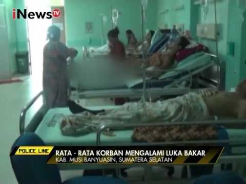 Sumur bor meledak, para penambang ilegal di Sumsel alami luka bakar - Police Line 14/01