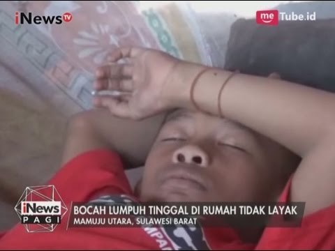 [Miris] Bocah Lumpuh Sejak Lahir & Tinggal di Pinggir Sungai Berarus Deras - iNews Pagi 11/05