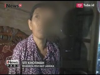 Terkena Penyakit Langka, Ibu Ini Harus Pasrah Tak Ada yang Bisa Menyembuhkan - iNews Pagi 12/05