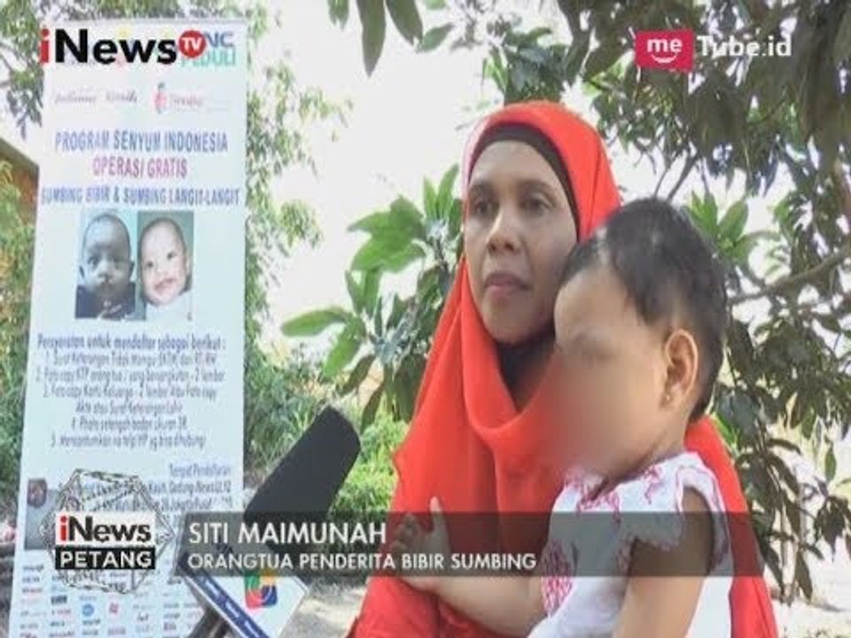 Penderita BIbir Sumbing Mendapatkan Operasi Gratis Dari MNC Group - iNews Petang 31/05