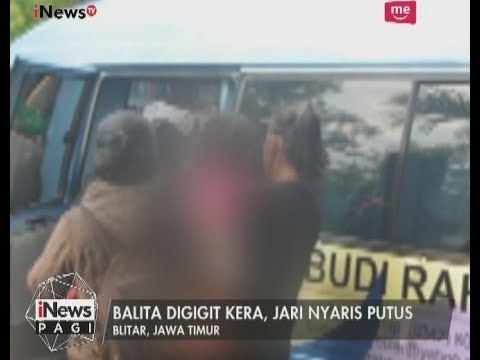 Seorang Balita di Blitar DiRawat di RS Usai Jarinya Nyaris Putus Digigit Kera - iNews Pagi 02/07