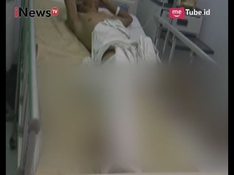 3 Orang Meninggal Pada Kecelakaan Bus Tabrak Motor di Pemalang - iNews Malam 03/07