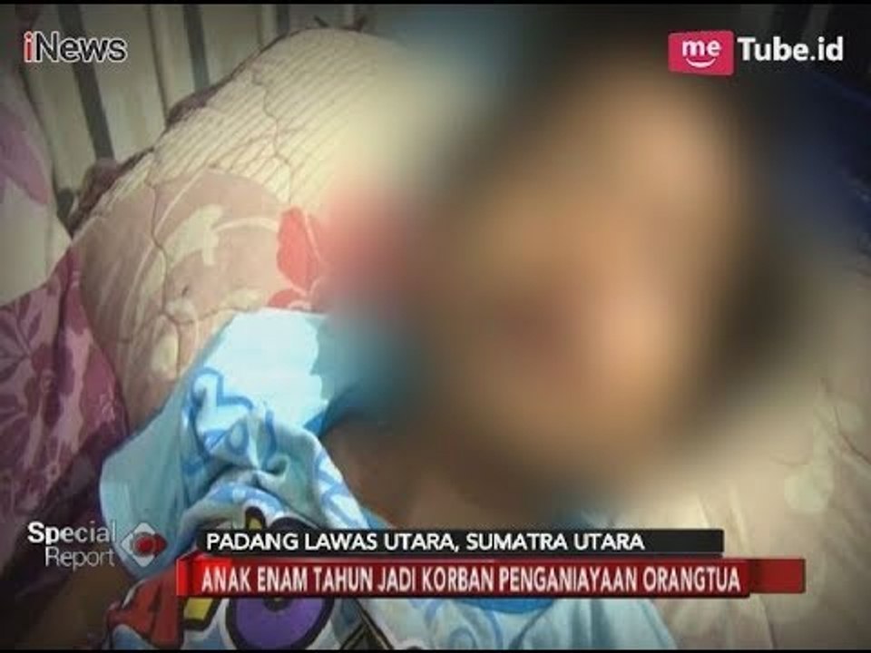 Biadab!! Bocah 6 Tahun Dianiaya Ibu Kandung dan Ayah Tiri Hingga Terlantar - Special Report 1101 2