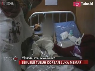 Dianiaya Tante, Balita di Tasikmalaya Dehidrasi Hingga Tak Sadarkan Diri - Special Report 12/01