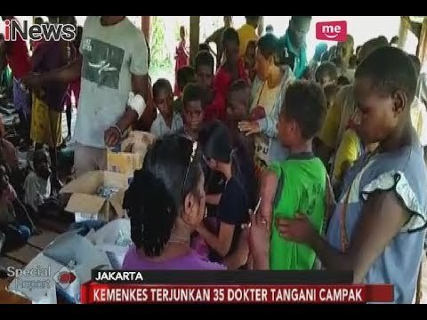 Kemenkes, TNI & POLRI Kirim Dokter Juga Tim Kesehatan ke Asmat, Papua - Special Report 16/01