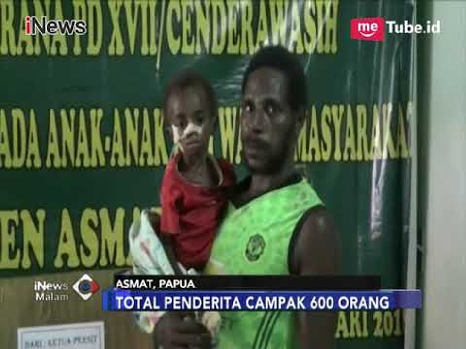 Dalam 4 Bulan, 67 Anak Asmat Meninggal akibat Campak dan Gizi Buruk - iNews Malam 18/01
