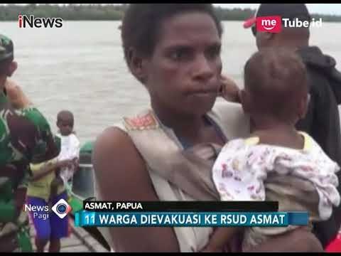 Terserang Wabah Campak, 11 Warga Dievakuasi ke RSUD Asmat - iNews Pagi 21/01