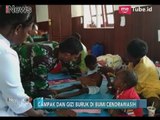 Puluhan Anak Terindikasi Campak dan Gizi Buruk Akhirnya Dapatkan Pengobatan Rutin - iNews Pagi 28/01