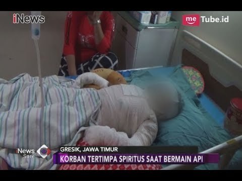 Tertimpa Spiritus Saat Bermain Api, Bocah TK Terbakar - iNews Sore 28/01