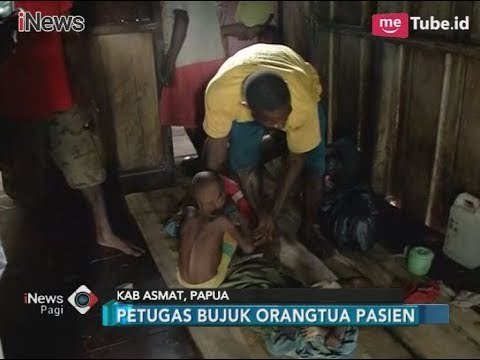 2 Balita Pengidap Campak Kronis Akhirnya Dievakuasi ke RSUD di Kota Agats - iNews Pagi 30/01
