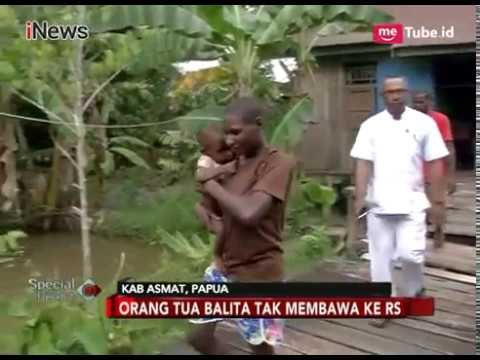 Tak Dibawa ke RS, Dua Balita Pasien Campak di Asmat Kronis - Special Report 30\/01