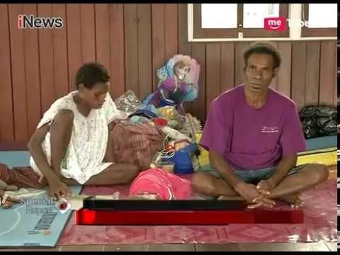 Fase 10 Hari Tanggap Darurat Campak, 196 Kampung di Asmat Tertangani - Special Report 31/01