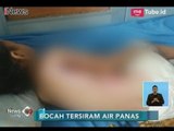 Tak Ada Biaya, Bocah 4 Tahun yang Tersiram Air Mendidih Tak Dapat ke Rumah Sakit - iNews Siang 01/02