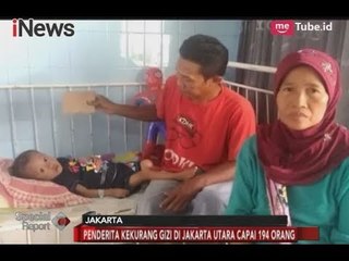 Ironis! Anggaran Belanja Melimpah, Anak Ibu Kota Masih Banyak Terserang Gizi Buruk  - Special Report