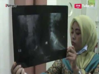 Bayi di Makassar Kena Peluru Nyasar saat Tidur - iNews Malam 02/02